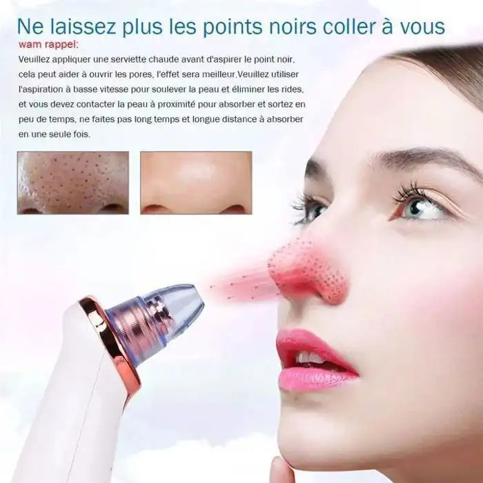 Aspirateur points noirs - XR Cleaner - Électrique - 5 têtes d'aspiration - Rechargeable